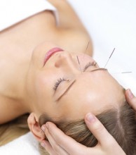 Acupuncture therapy - alternative medicine